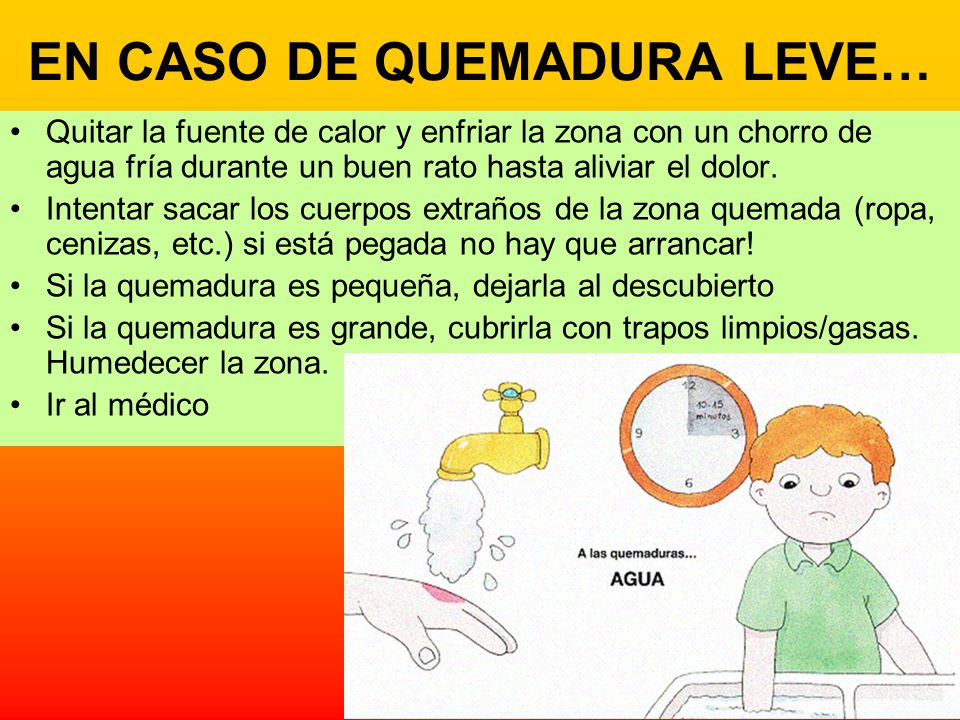que poner en caso de quemaduras leves